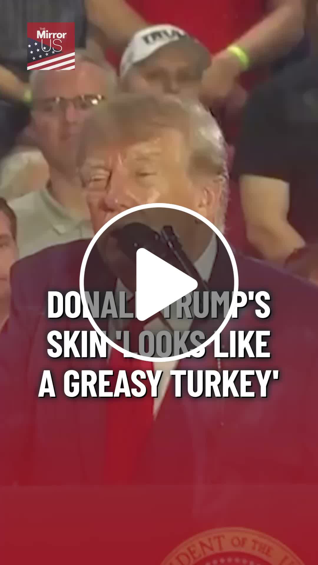 Donald Trump triggers alarm as his evolving skin 'looks like greasy ...